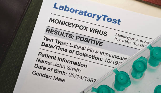 Monkeypox virus test results document with vials stock photo