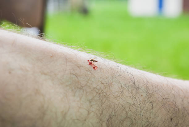 Mosquito with blood sitting on the leg. Insects bite in the summer....