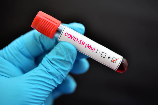 Mu variant COVID-19 positive Mu variant COVID-19 positive, blood sample tube positive with mu variant of COVID-19 coronavirus covid variant stock pictures, royalty-free photos & images