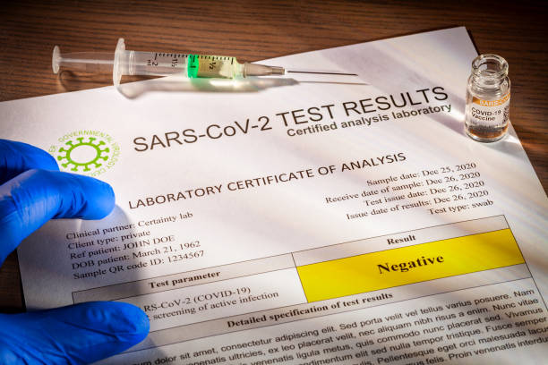 Negative test result document for SARS-CoV-2 coronavirus causing COVID-19 stock photo