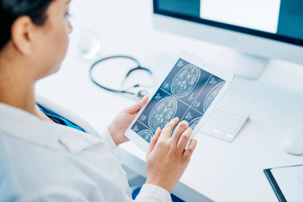 Neurologists treat an ever-growing variety of conditions affecting the brain Shot of a young doctor analysing brain scans on a digital tablet neurologist stock pictures, royalty-free photos & images