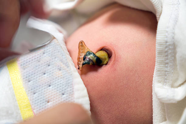 Newborn baby navel stock photo