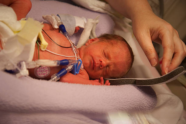 Newborn Preemie Newborn Premature Infant with Parent's Hand dexcom extra adhesive stock pictures, royalty-free photos & images