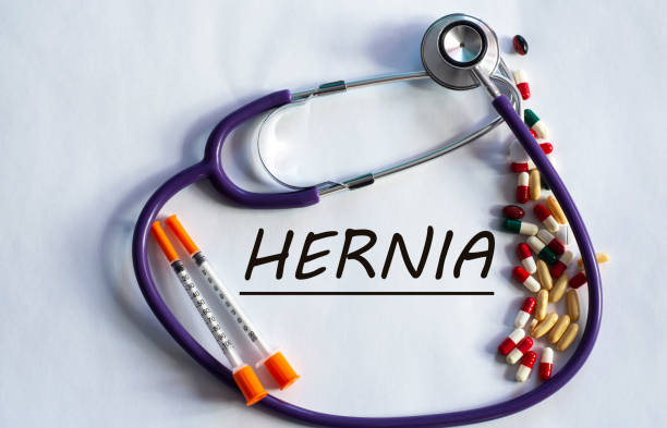 Notebook pade with word HERNIA on a table with a stethoscope and pills Notebook pade with word HERNIA on a table with a stethoscope and pills. Medical concept hernia inguinal stock pictures, royalty-free photos & images