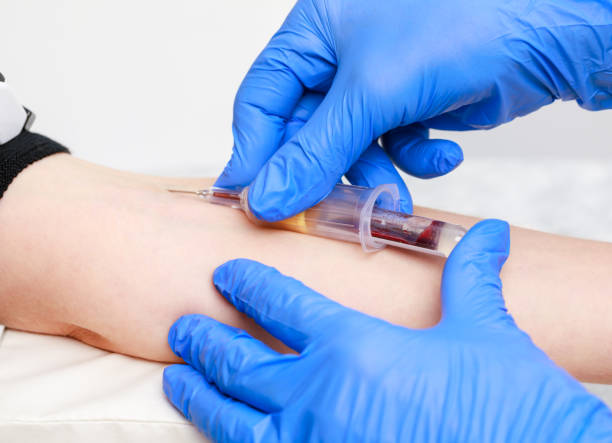 Nurse takes a blood sample from arm vein performing a venipuncture Close-up shot of doctor or nurse taking a blood sample from arm vein with a vacutainer. Venipuncture or venepuncture procedure blood testing stock pictures, royalty-free photos & images