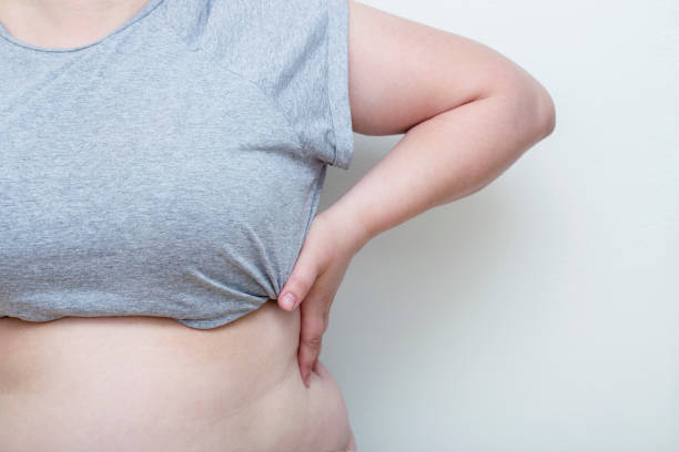 Obesity. The Obese Woman Held Her Fat Belly In Her Hands stock photo