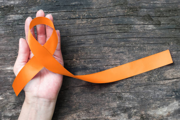 Orange ribbon on old aged background raising awareness on leukemia, kidney cancer, RSD multiple sclerosis Satin fabric color symbolic concept for public support on people living with tumor disease Orange ribbon on old aged background raising awareness on leukemia, kidney cancer, RSD multiple sclerosis Satin fabric color symbolic concept for public support on people living with tumor disease multiple sclerosis stock pictures, royalty-free photos & images