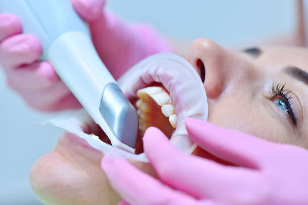 Orthodontist using 3D intraoral scanner for scanning teeth patient's. stock photo