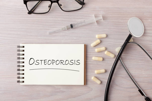 Osteoporosis word as medical concept OSTEOPOROSIS text written on notebook with stethoscope, syringe and pills. Medical and health care concept. osteoporosis photos stock pictures, royalty-free photos & images