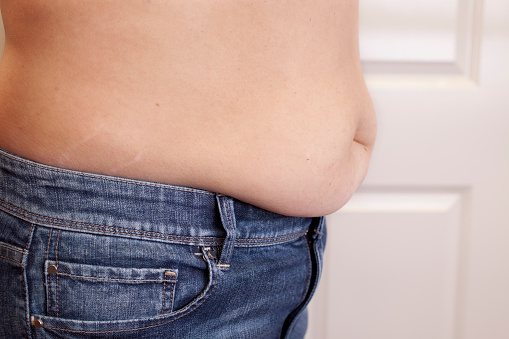 Overweight Woman With Belly Hanging Over Jeans Stock Photo ...