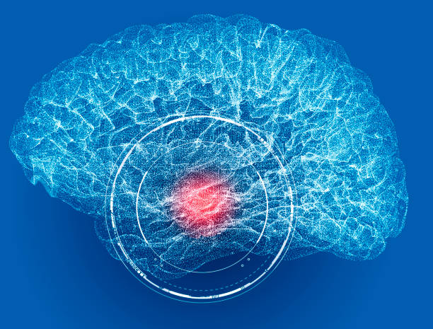 Pain in the head, brain and synapses, cognitive problems, mental deficit. Aneurysm. Stroke stock photo