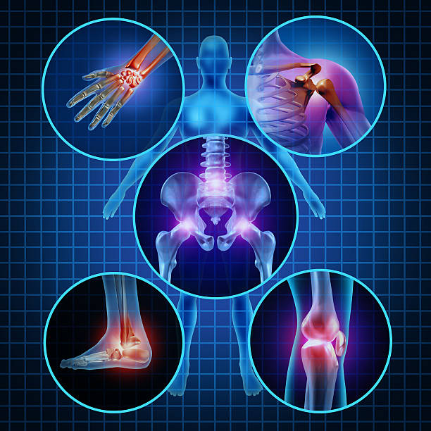 Painful Joints Painful joints human anatomy concept with the body as a group of circular panels of sore areas as a pain and injury or arthritis illness symbol for health care and medical symptoms due to aging or sports and work injury. human joint stock pictures, royalty-free photos & images