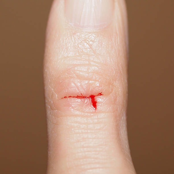 Paper Cut Finger Stock Photos Pictures Royalty Free Images iStock Paper Cut Finger Stock Photos Pictures Royalty Free Images iStock