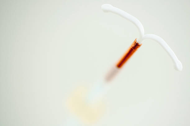 ParaGard Copper IUDs iud stock pictures, royalty-free photos & images