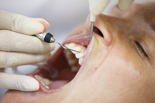 Can Periodontal Gum Disease Be Reversed?