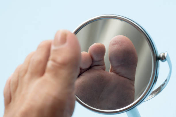 Person looking at the sole of the foot in a mirror. Person looking at the sole of the foot in a mirror, to check if there is no diabetic foot, as possible sores foot exam diabetes stock pictures, royalty-free photos & images