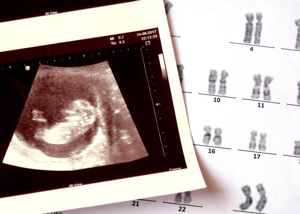 2D picture of ultrasound baby with chromosomes analysis report. 2D picture of ultrasound baby with chromosomes analysis report. chromosome stock pictures, royalty-free photos & images