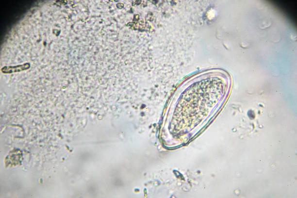 pinworm egg under light microscopy stock photo