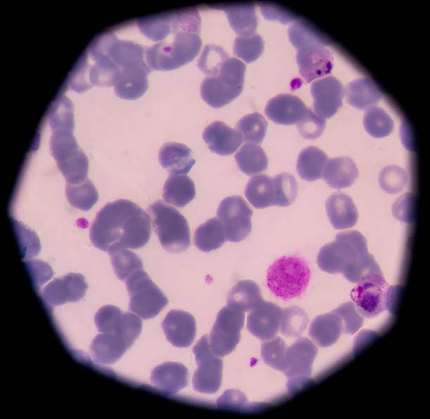 Plasmodium vivax is a protozoal parasite and a human pathogen.pl Plasmodium vivax is a protozoal parasite and a human pathogen.plasmodium vivax growing trophozoite stage malaria parasite stock pictures, royalty-free photos & images