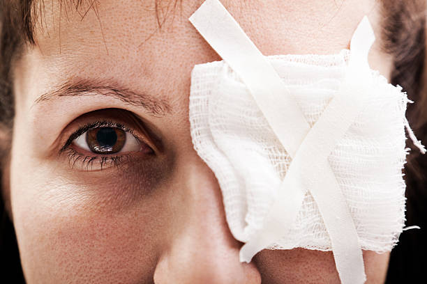 A plaster patch covering a person's wounded eye stock photo