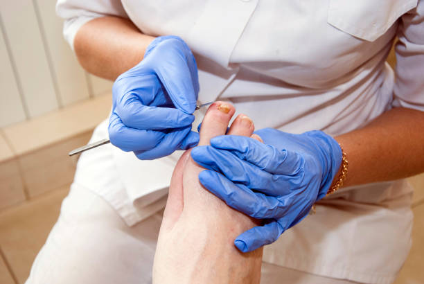 Podiatry. Diabetic foot Podiatry. Diabetic foot. Foot Podiatrist foot exam diabetes stock pictures, royalty-free photos & images