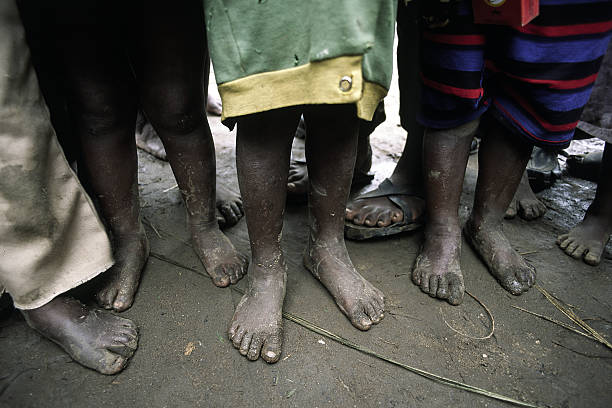 Poor African children waiting for food barefoot Poor African children waiting for food barefoot barefoot photos stock pictures, royalty-free photos & images