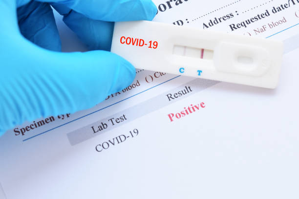 Positive test result by using rapid test device for COVID-19 Positive test result by using rapid test device for COVID-19, novel coronavirus 2019 found in Wuhan, China positive stock pictures, royalty-free photos & images