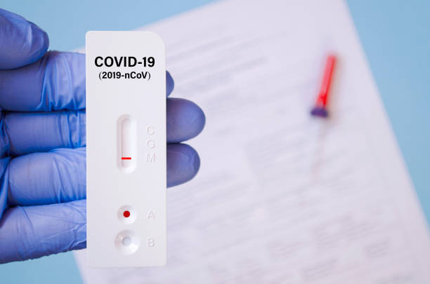 pozytywny wynik testu przy użyciu szybkiego testu dla covid-19, szybkiego szybkiego testu na obecność przeciwciał. laboratorium przeprowadza szybkie badanie diagnostyczne przeciwciał w celu wykrycia obecności antygenów choroby covid-19. - covid test zdjęcia i obrazy z banku zdjęć