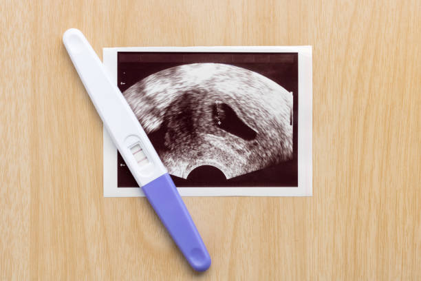 Pregnancy test with ultrasound picture of baby on wooden background. Pregnancy care concept. Pregnancy test with ultrasound picture of baby on wooden background. Pregnancy care concept. positive pregnancy test stock pictures, royalty-free photos & images