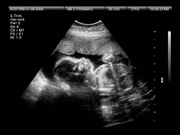 Pregnancy Ultrasound in 3rd Trimester stock photo