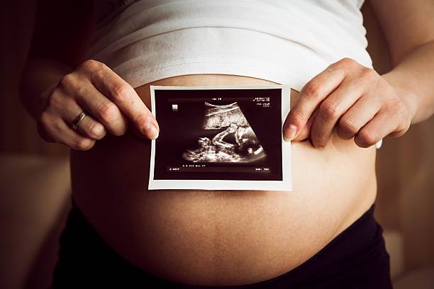 Pregnant woman holding ultrasound image stock photo