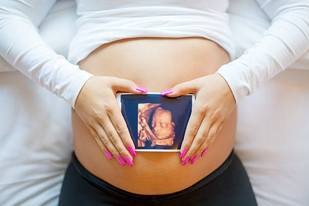 Pregnant woman holds ultrasound photo on the belly in bed stock photo