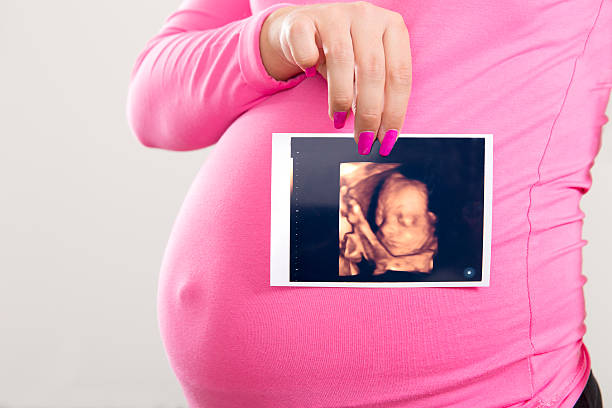 Pregnant woman holds ultrasound photo on the belly stock photo