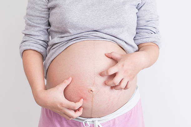 Pregnant woman scratching her belly stock photo