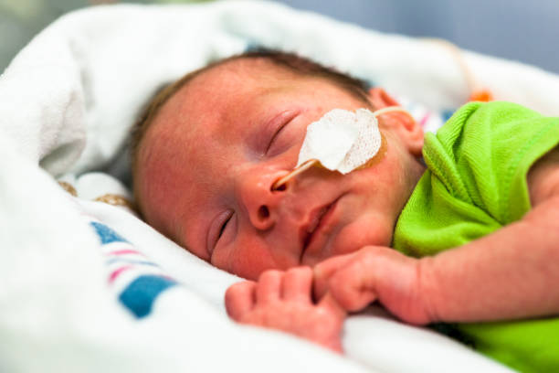 Premature baby in the neonatal intensive care unit with a nasal feeding tube. stock photo