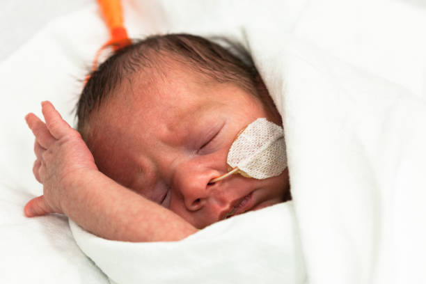 Premature baby in the neonatal intensive care unit with a nasal feeding tube. stock photo
