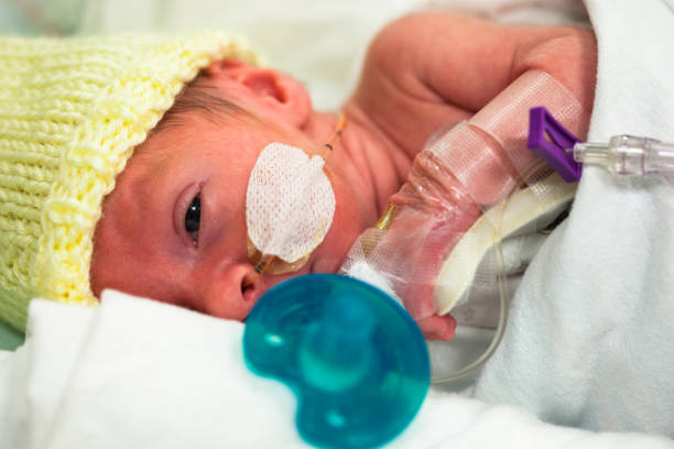 Premature baby in the neonatal intensive care unit with a pacifier stock photo