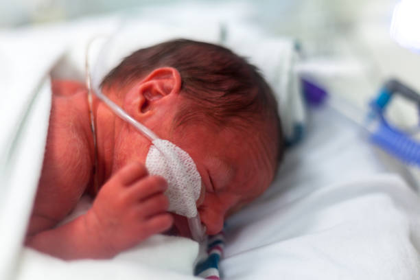 Premature baby in the neonatal intensive care unit with hi flow stock photo