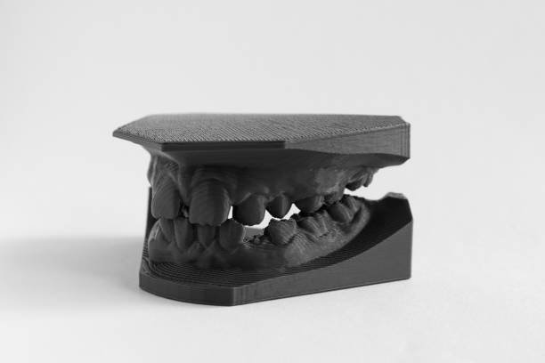3D printer denture girl 9 years dentistry stock photo