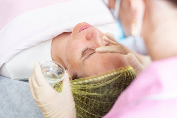 A professional cosmetologist applies a chemical peeling solution to the patient on the skin of the face with the help of hands in gloves. stock photo