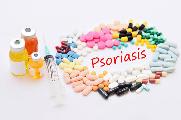 free psoriasis medicine