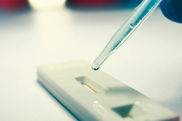 Rapid Test with pipette dropping analysis fluid stock photo