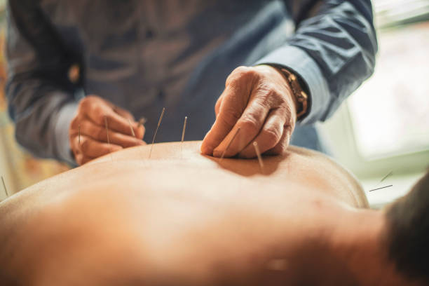 Receiving acupuncture therapy Close-up view of a man lying face down and being treated by the acupuncturist. He's applying the needle on man's back area. acupuncture stock pictures, royalty-free photos & images