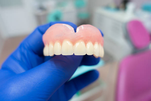 removable denture in the hands of a doctor stock photo