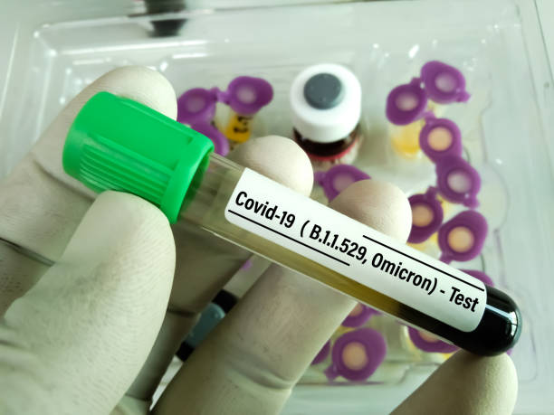 연구원은 covid-19 omicron b.1.529 시험의 새로운 변이체를 위한 혈액 견본을 보유합니다. - omicron covid 뉴스 사진 이미지