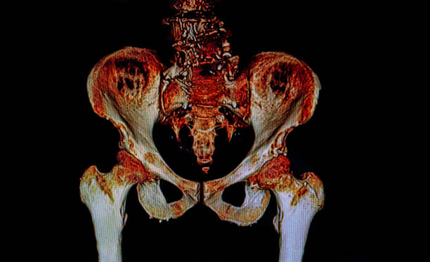 Rx image of pelvis bones Rx image of pelvis bones pelvic floor stock pictures, royalty-free photos & images