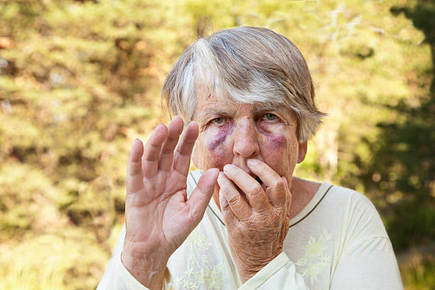 Scared and maltreated senior woman with big bruises stock photo