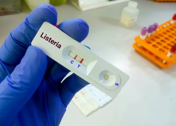 científico sostiene casete de prueba rápida para la prueba de listeria, diagnóstico para listeriosis - listeria fotografías e imágenes de stock