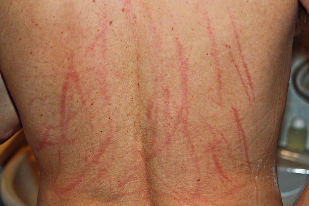 Scratches stock photo