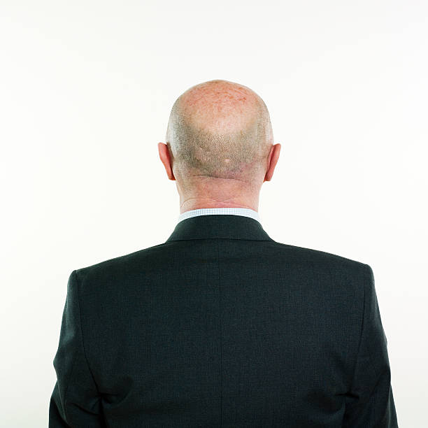 Bald Head Back Stock Photos Pictures And Royalty Free Images Istock